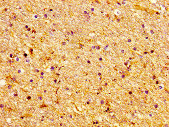 Lass1 Antibody in Immunohistochemistry (Paraffin) (IHC (P))