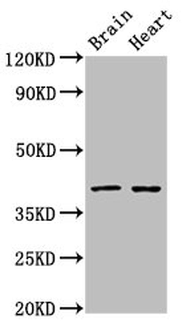 Lass1 Antibody in Western Blot (WB)