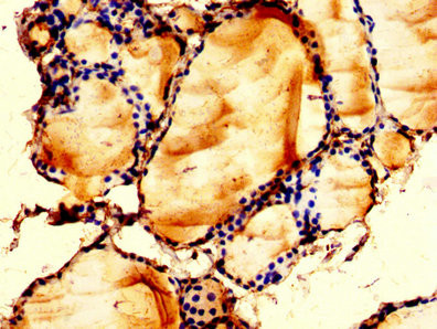 LPCAT2 Antibody in Immunohistochemistry (Paraffin) (IHC (P))