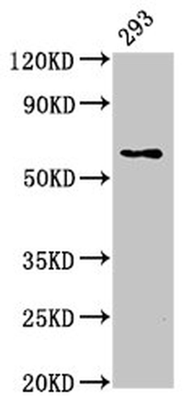 LPCAT2 Antibody in Western Blot (WB)