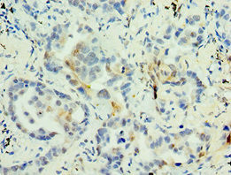 MAGEA6 Antibody in Immunohistochemistry (Paraffin) (IHC (P))