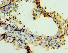 MAGEA6 Antibody in Immunohistochemistry (Paraffin) (IHC (P))