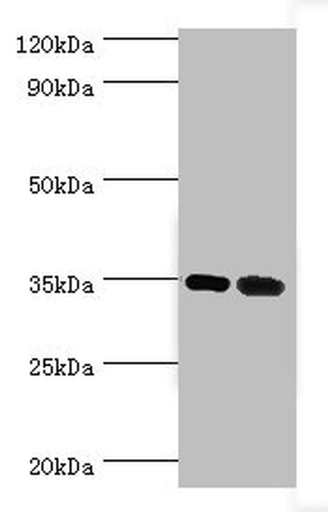 MAGEA6 Antibody in Western Blot (WB)