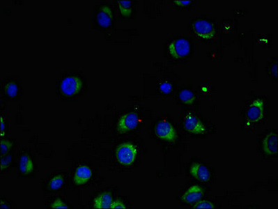 MAK Antibody in Immunocytochemistry (ICC/IF)