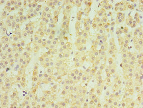 MATN3 Antibody in Immunohistochemistry (Paraffin) (IHC (P))