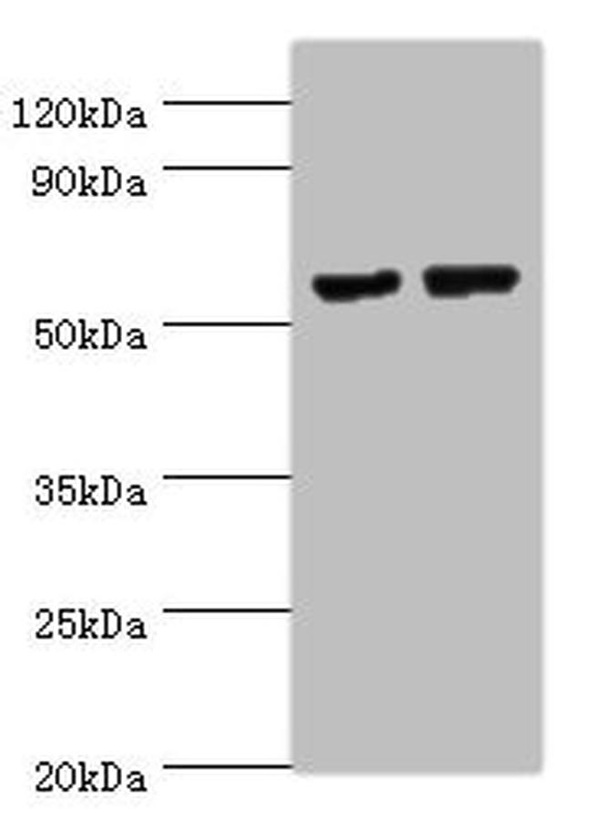 MATN3 Antibody in Western Blot (WB)