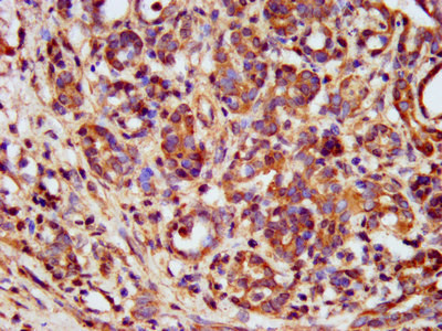 METAP1 Antibody in Immunohistochemistry (Paraffin) (IHC (P))