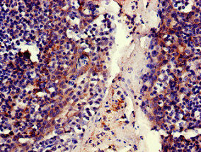 MFI2 Antibody in Immunohistochemistry (Paraffin) (IHC (P))