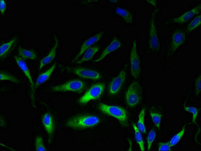 MPV17 Antibody in Immunocytochemistry (ICC/IF)