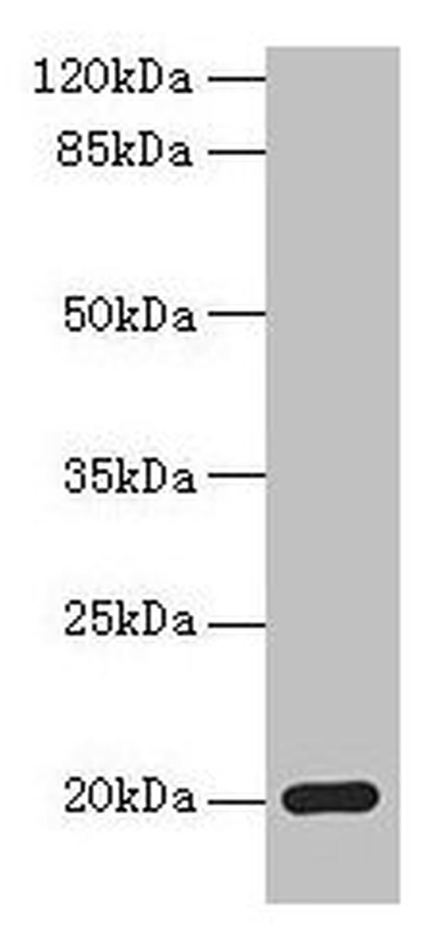 MPV17 Antibody in Western Blot (WB)