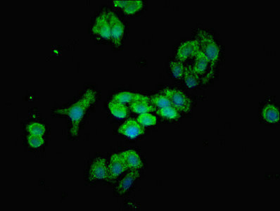 MTX2 Antibody in Immunocytochemistry (ICC/IF)