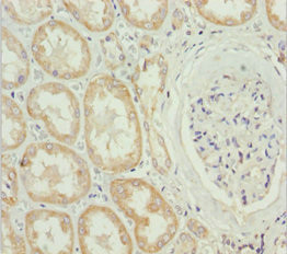 MTX2 Antibody in Immunohistochemistry (Paraffin) (IHC (P))