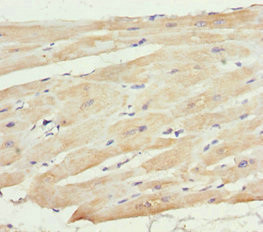 MTX2 Antibody in Immunohistochemistry (Paraffin) (IHC (P))