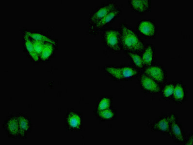 MTX2 Antibody in Immunocytochemistry (ICC/IF)