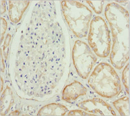 MTX2 Antibody in Immunohistochemistry (Paraffin) (IHC (P))