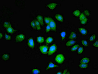 NAT2 Antibody in Immunocytochemistry (ICC/IF)