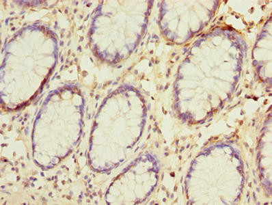 NAT2 Antibody in Immunohistochemistry (Paraffin) (IHC (P))