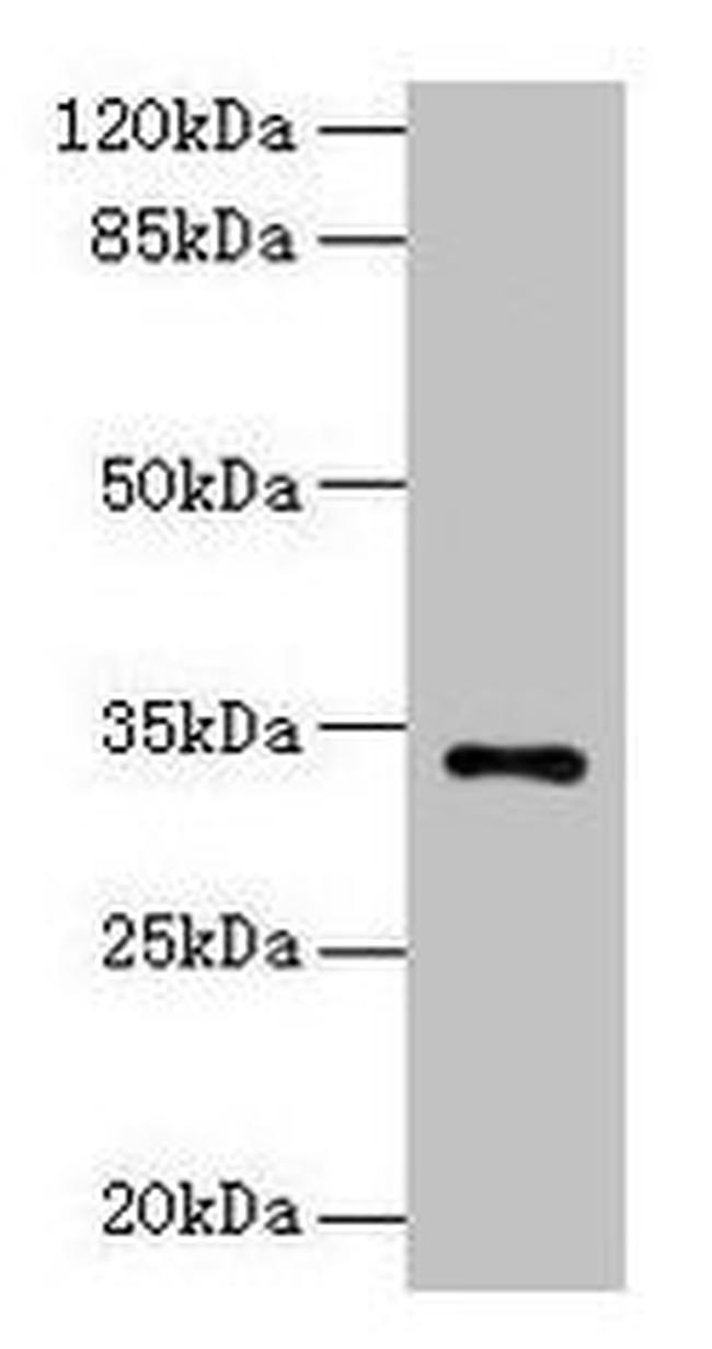 NAT2 Antibody in Western Blot (WB)