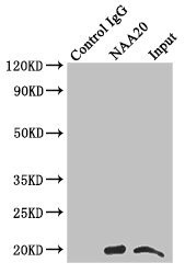 NAA20 Antibody in Immunoprecipitation (IP)