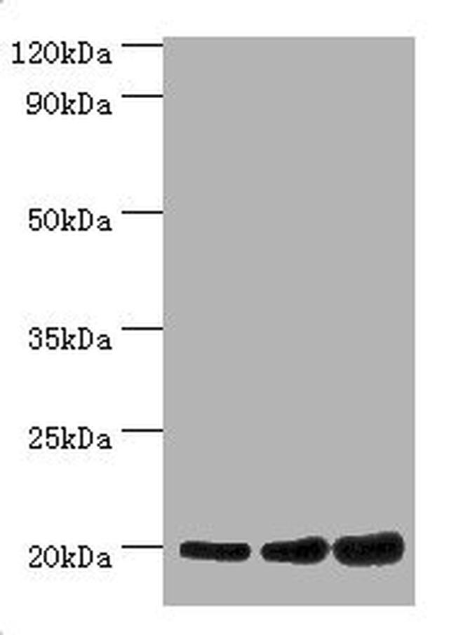 NAA20 Antibody in Western Blot (WB)