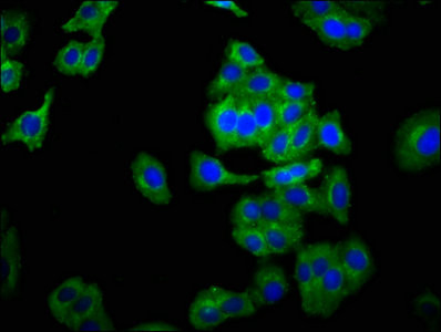 NCAM2 Antibody in Immunocytochemistry (ICC/IF)