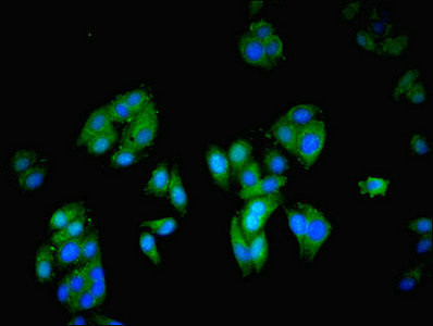 NCK2 Antibody in Immunocytochemistry (ICC/IF)