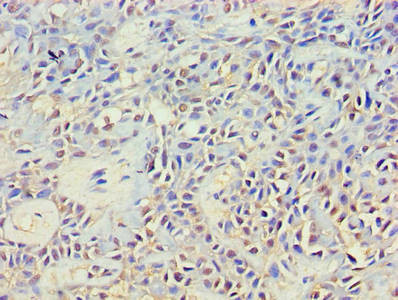 NCK2 Antibody in Immunohistochemistry (Paraffin) (IHC (P))