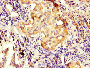 NOXA1 Antibody in Immunohistochemistry (Paraffin) (IHC (P))