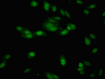 NTHL1 Antibody in Immunocytochemistry (ICC/IF)