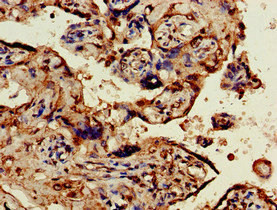 OBSL1 Antibody in Immunohistochemistry (Paraffin) (IHC (P))