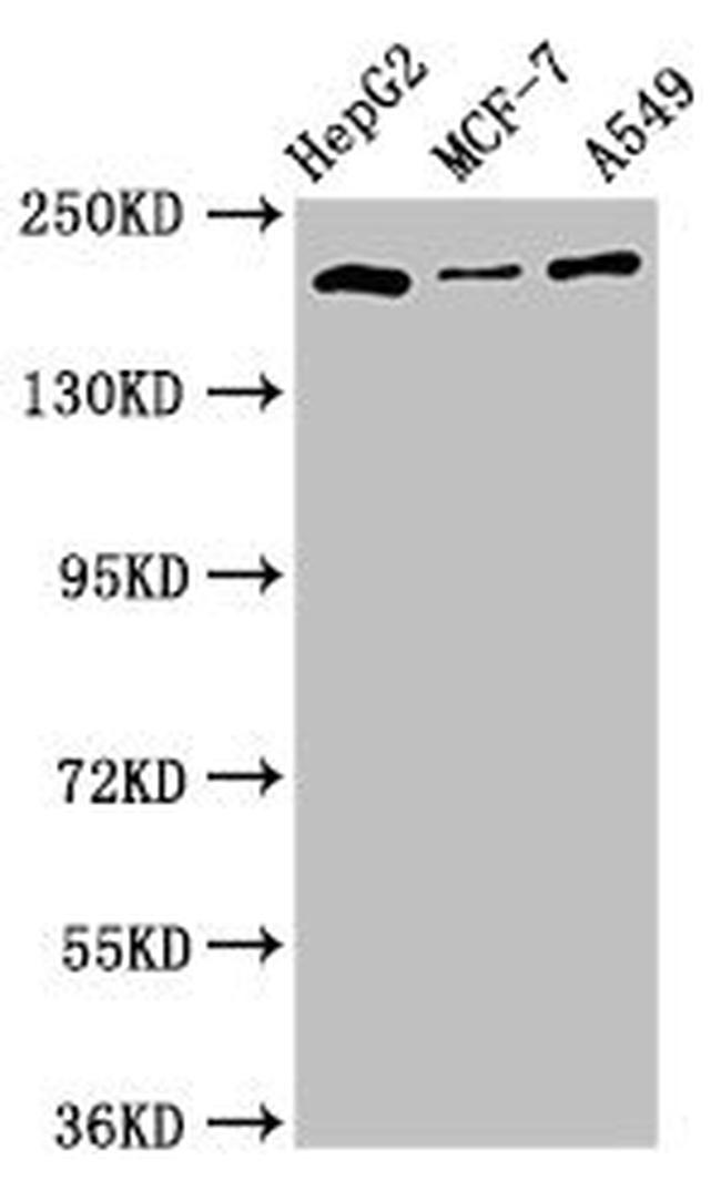 OBSL1 Antibody in Western Blot (WB)