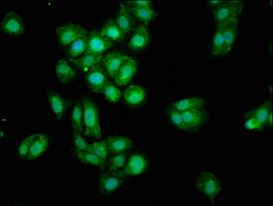 Mimecan Antibody in Immunocytochemistry (ICC/IF)