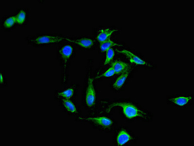 PAK3 Antibody in Immunocytochemistry (ICC/IF)