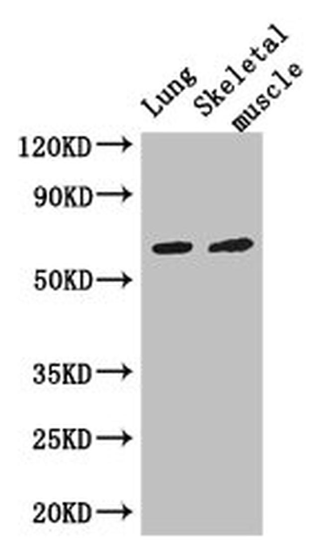 PAK3 Antibody in Western Blot (WB)