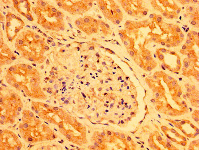 PEAR1 Antibody in Immunohistochemistry (Paraffin) (IHC (P))