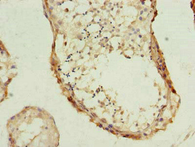 PHF10 Antibody in Immunohistochemistry (Paraffin) (IHC (P))