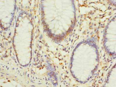 PHF10 Antibody in Immunohistochemistry (Paraffin) (IHC (P))