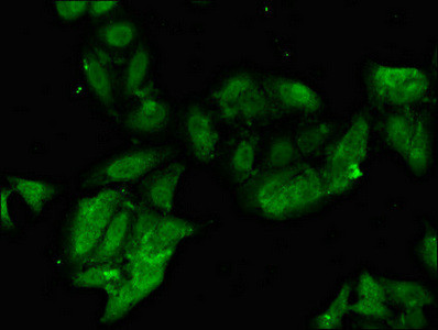 PHF21A Antibody in Immunocytochemistry (ICC/IF)