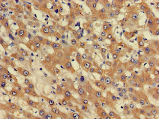 PHF21A Antibody in Immunohistochemistry (Paraffin) (IHC (P))