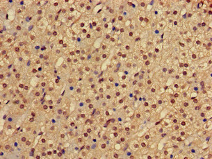 PHF21A Antibody in Immunohistochemistry (Paraffin) (IHC (P))