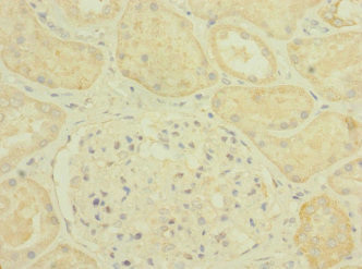 PLXNB2 Antibody in Immunohistochemistry (Paraffin) (IHC (P))