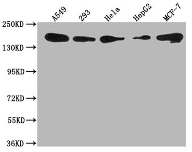 PLXNB2 Antibody in Western Blot (WB)