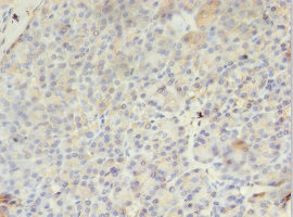 PMM1 Antibody in Immunohistochemistry (Paraffin) (IHC (P))