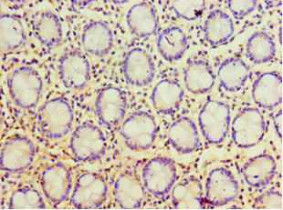 POP7 Antibody in Immunohistochemistry (Paraffin) (IHC (P))