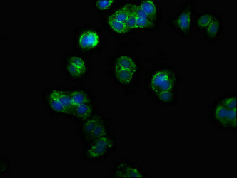 PPM1F Antibody in Immunocytochemistry (ICC/IF)