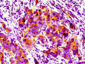 PPM1F Antibody in Immunohistochemistry (Paraffin) (IHC (P))