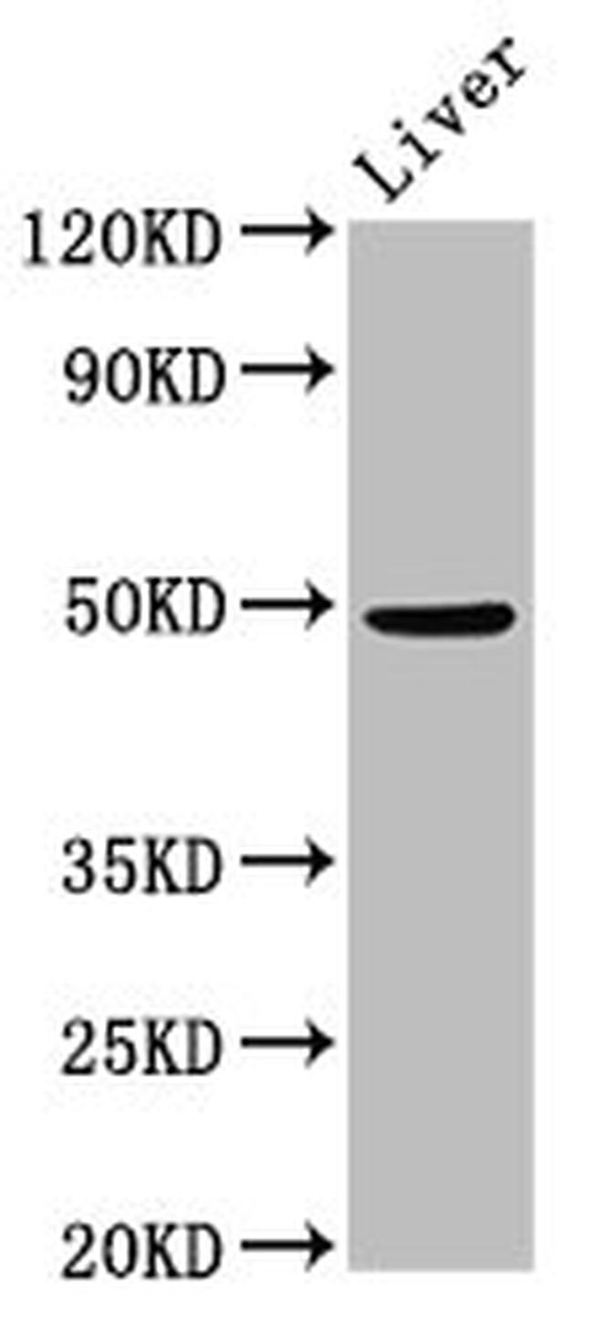 PPM1F Antibody in Western Blot (WB)