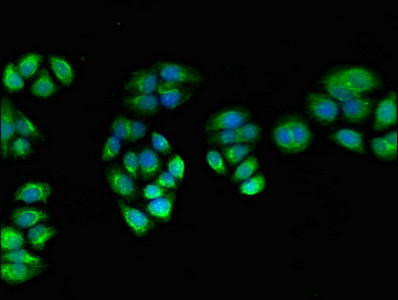 PPOX Antibody in Immunocytochemistry (ICC/IF)