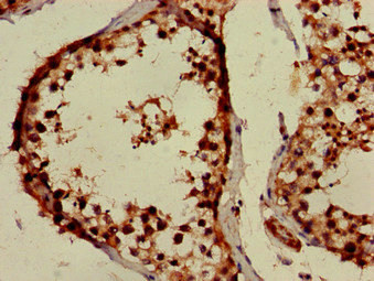 PPOX Antibody in Immunohistochemistry (Paraffin) (IHC (P))