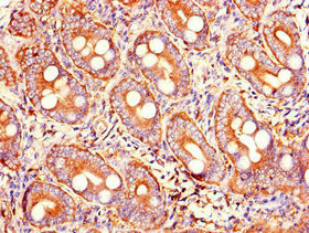 Trypsin 2 Antibody in Immunohistochemistry (Paraffin) (IHC (P))